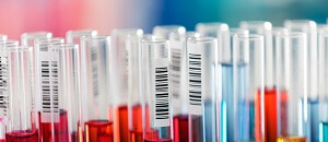 Test Tubes